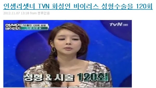 韩国综艺节目 火星人病毒 化名 “徐珥秀”花1亿韩元整容120次的女孩上节目