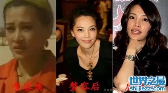孔维整容失败前后对比照片,美过赵薇如今满脸是坑