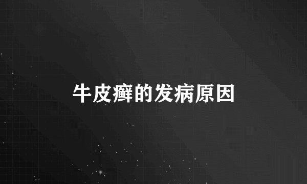 牛皮癣的发病原因