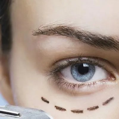 朝天鼻整容要多少钱