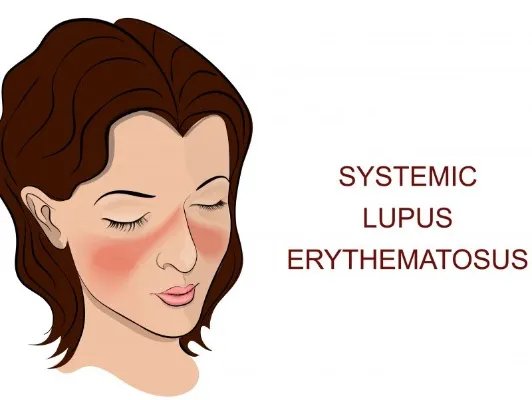 特效祛斑的方法