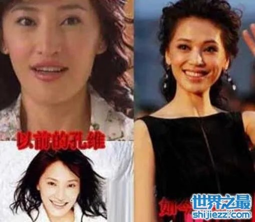 孔维整容失败前后对比照片,美过赵薇如今满脸是坑