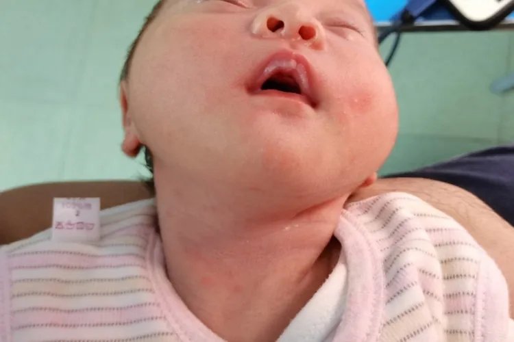 正常婴儿嘴唇图片大全