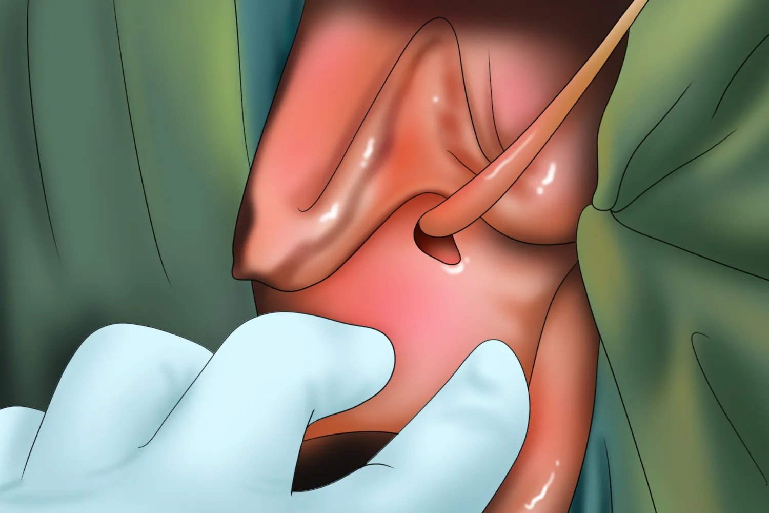 什么是石女图片