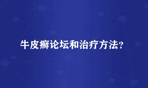 牛皮癣论坛和治疗方法？