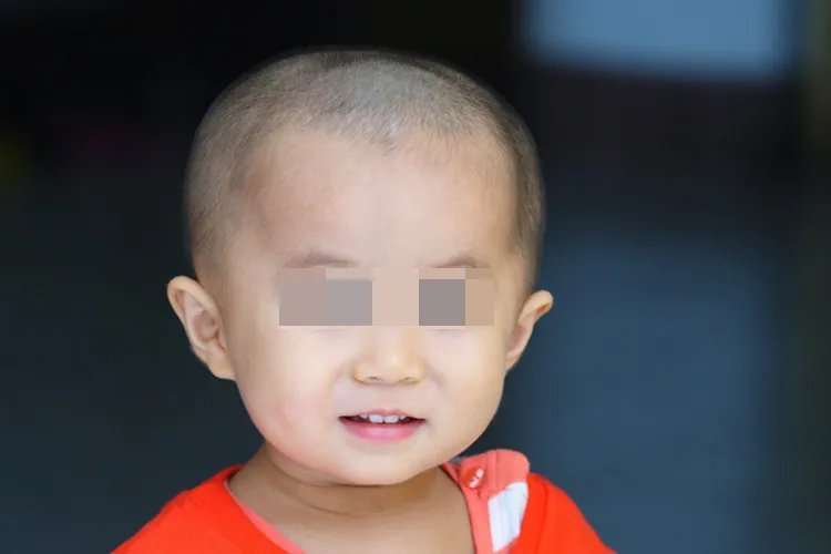 头两边骨头太凸图片