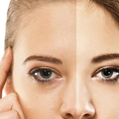 祛除痘印最好的产品