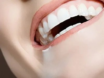 深圳种植牙价格