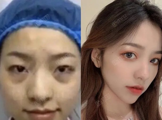 抖音刘思瑶nice现实照片 素颜照整容了吗