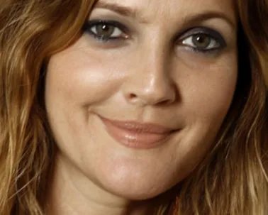 眼角纹除皱多少钱