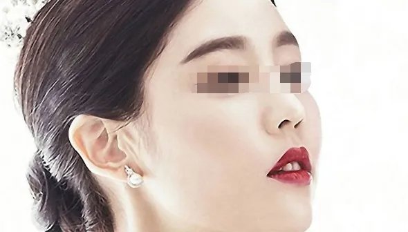 botox瘦脸针价格是多少钱