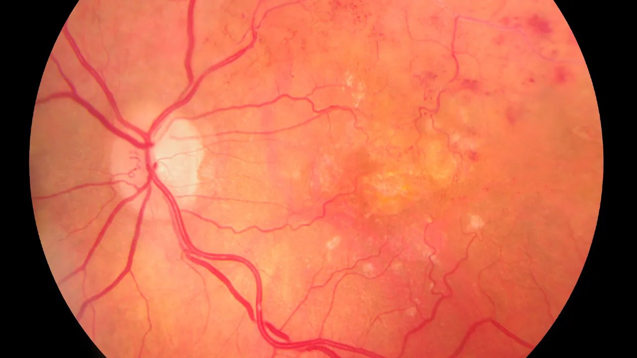 手机一族必看食物推荐 这几种护眼食物不能少