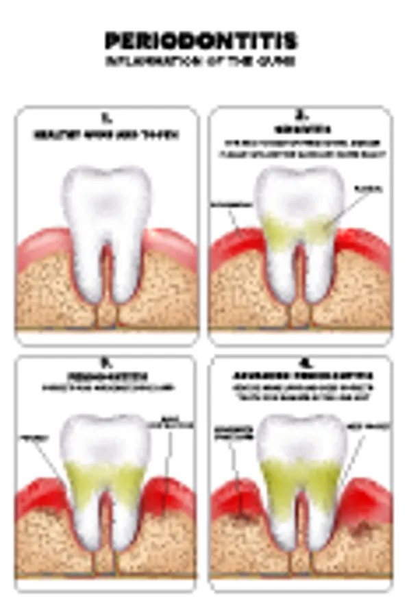 南京牙齿美白一般多少钱