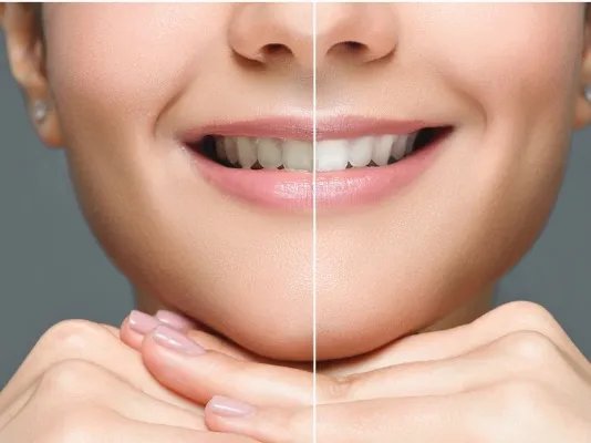 男士脸部美白的方法有哪些