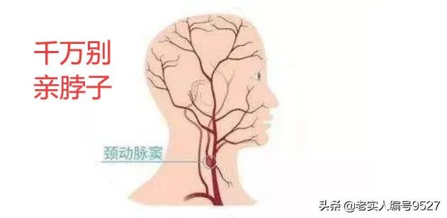 男子入室盗窃欲拍晕主人结果把人打醒,用手打后脖颈真能打晕吗?