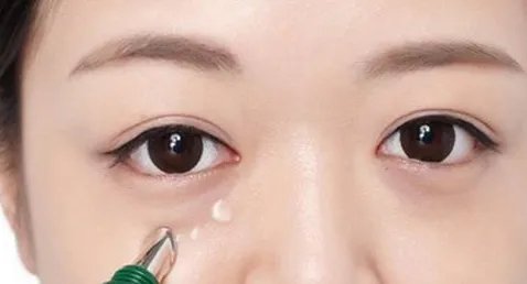 重庆眼部手术哪几个整形医院口碑好