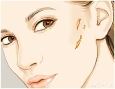 治愈疤痕疙瘩有哪些办法？