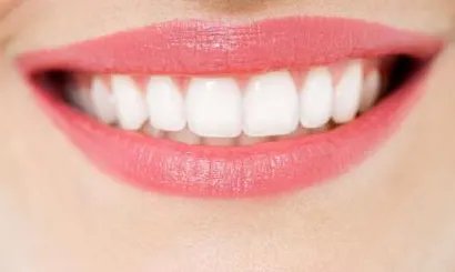 美容冠矫正多少钱