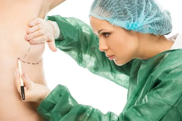 自体丰胸手术的价格是多少