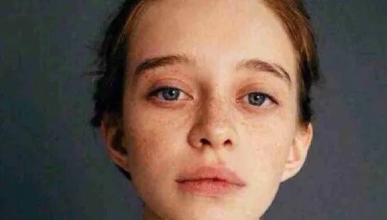 北京打玻尿酸贵吗