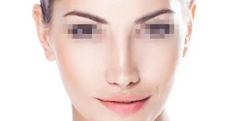 鼻头鼻翼整形大概要多少钱