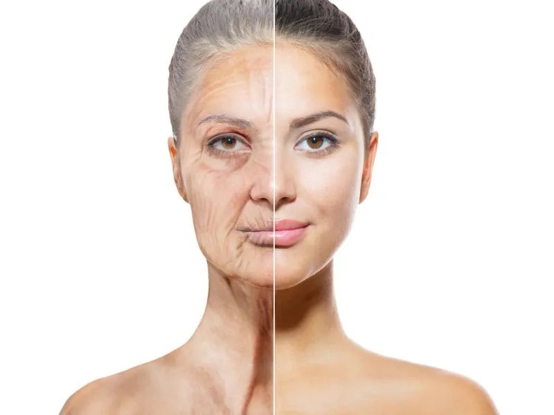 如何消除眼袋皱纹