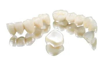 美容冠是什么？