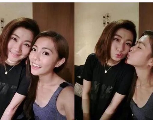 selina肿成面包超人 都是过敏惹的祸