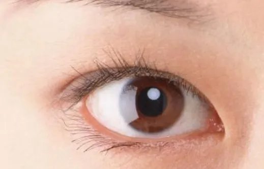 韩式无痕祛眼袋手术价格多少钱