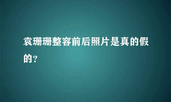 袁珊珊整容前后照片是真的假的？