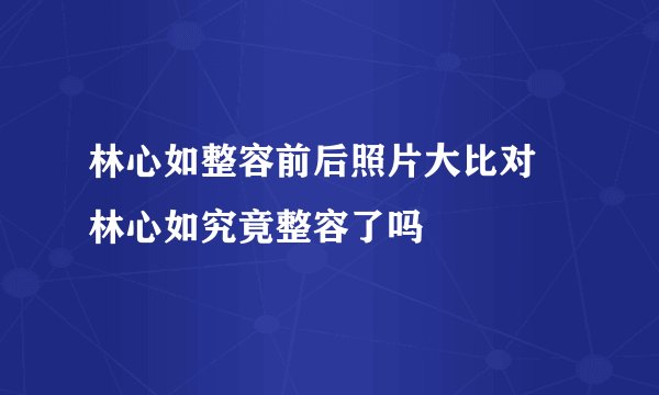 林心如整容前后照片大比对 林心如究竟整容了吗