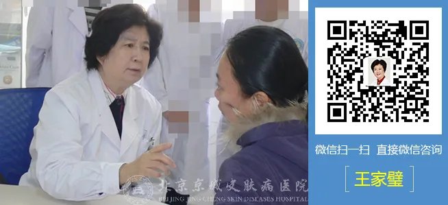 北京鱼鳞病医院哪里最好