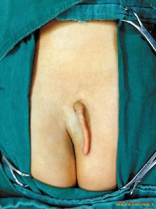 瑞士77岁双性人昼父夜妓 揭秘各路畸形“怪人”