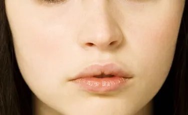 黑脸娃娃祛斑优势