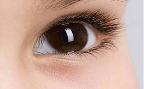 眼部手术上海做的好的整形医院