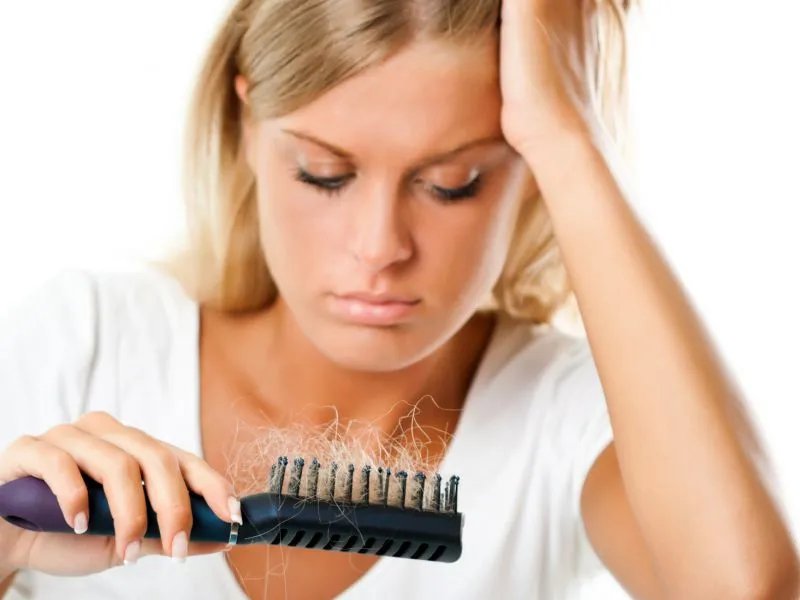 如何治疗油脂性脱发