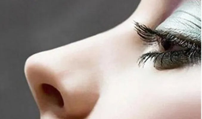 隆鼻鼻翼缩小多少钱