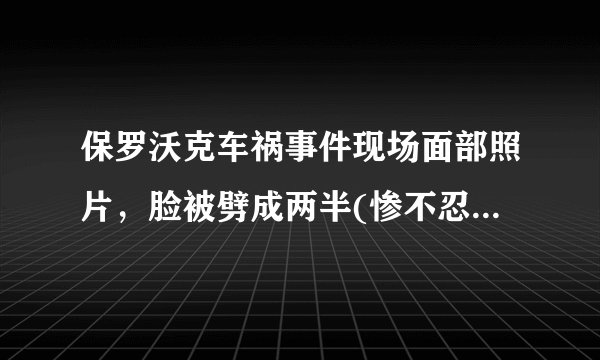 保罗沃克车祸事件现场面部照片，脸被劈成两半(惨不忍睹)—飞外