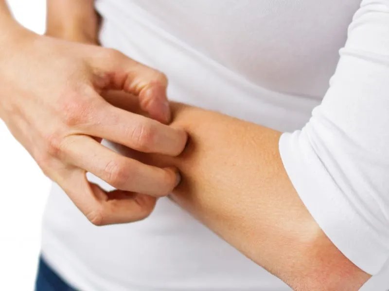 秋冬季节皮肤干燥怎么办