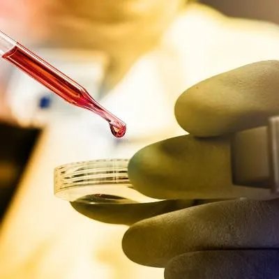 素女散能治疗宫颈肥大吗