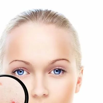 老中医祛斑霜怎么样