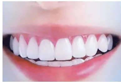 人工种植牙价格