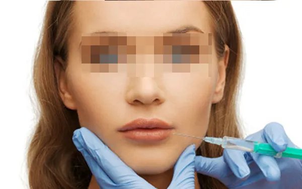 脸部除皱手术费用多少钱