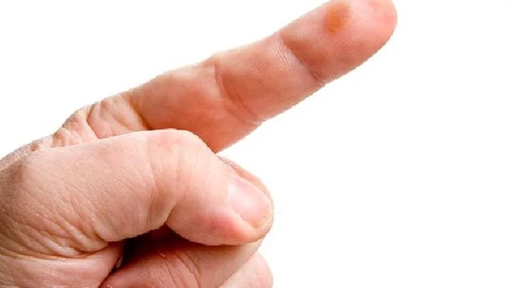 脸上色斑怎么办?试试这些方法