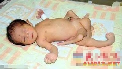 瑞士77岁双性人昼父夜妓 揭秘各路畸形“怪人”