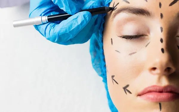 玻尿酸除皱到底好不好