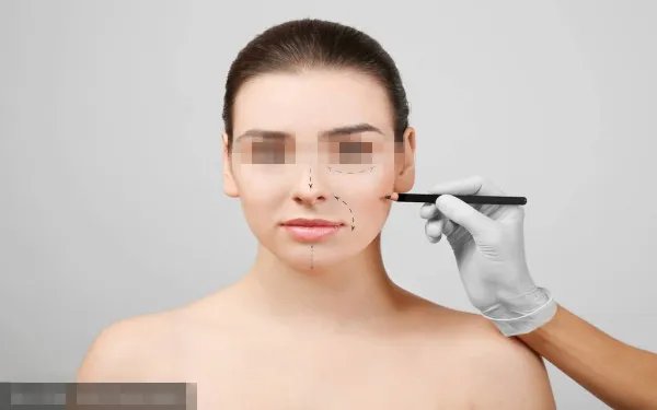 botox除皱多少钱