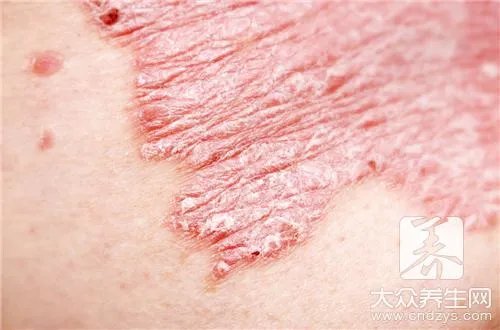 何首乌的功效与作用及食用方法有哪些？