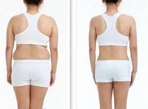 苏州吸脂手术医院哪家好？