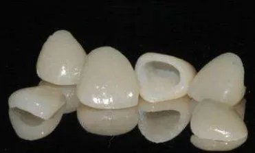 美容冠是什么？